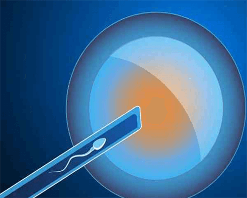 高龄女性备孕二胎，孕前检查可不能